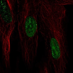 HSPB7 Polyclonal Antibody:Antibodies, Polyclonal