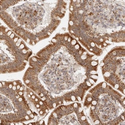 Invitrogen MRPL55 Polyclonal Antibody 100 &mu;L; Unconjugated:Antibodies,