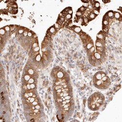 C1orf127 Polyclonal Antibody:Antibodies, Polyclonal