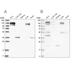 Invitrogen CGN Polyclonal Antibody 100 &mu;L; Unconjugated:Antibodies,