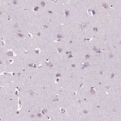 Invitrogen PRR9 Polyclonal Antibody 100 &mu;L; Unconjugated:Antibodies,