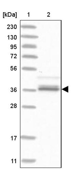 Invitrogen AKR1A1 Polyclonal Antibody 100 &mu;L; Unconjugated:Antibodies,