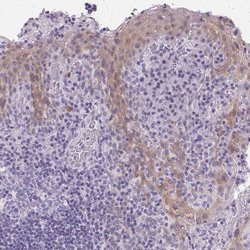 Invitrogen GBP6 Polyclonal Antibody 100 &mu;L; Unconjugated:Antibodies,