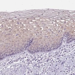 Invitrogen GBP6 Polyclonal Antibody 100 &mu;L; Unconjugated:Antibodies,