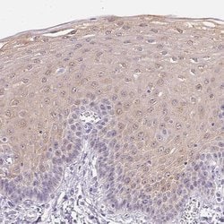 Invitrogen GBP6 Polyclonal Antibody 100 &mu;L; Unconjugated:Antibodies,