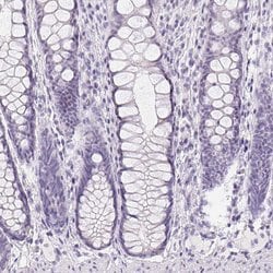 Invitrogen GBP6 Polyclonal Antibody 100 &mu;L; Unconjugated:Antibodies,