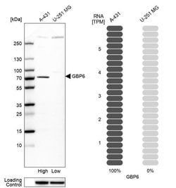 Invitrogen GBP6 Polyclonal Antibody 100 &mu;L; Unconjugated:Antibodies,