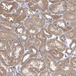 Invitrogen VAC14 Polyclonal Antibody 100 &mu;L; Unconjugated:Antibodies,