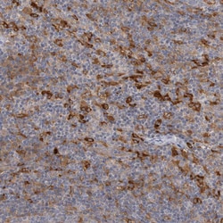 Invitrogen VAC14 Polyclonal Antibody 100 &mu;L; Unconjugated:Antibodies,