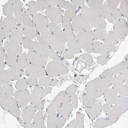 Invitrogen VAC14 Polyclonal Antibody 100 &mu;L; Unconjugated:Antibodies,