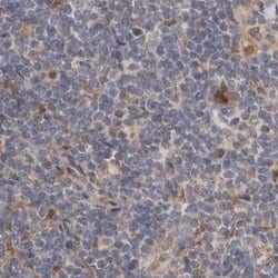 Invitrogen PNPO Polyclonal Antibody 100 &mu;L; Unconjugated:Antibodies,