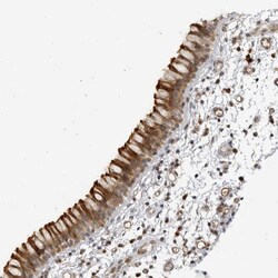 Invitrogen CNBD1 Polyclonal Antibody 100 &mu;L; Unconjugated:Antibodies,