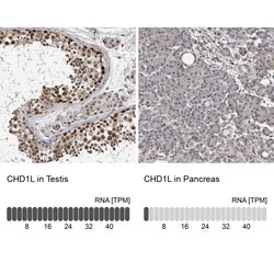 CHD1L Polyclonal Antibody, Invitrogen 100 &mu;L; Unconjugated:Antibodies