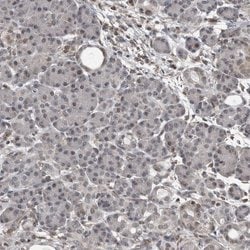 CHD1L Polyclonal Antibody, Invitrogen 100 &mu;L; Unconjugated:Antibodies