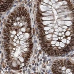 CHD1L Polyclonal Antibody, Invitrogen 100 &mu;L; Unconjugated:Antibodies