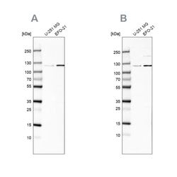 CHD1L Polyclonal Antibody, Invitrogen 100 &mu;L; Unconjugated:Antibodies