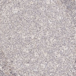 Invitrogen RPS6KL1 Polyclonal Antibody 100 &mu;L; Unconjugated:Anticuerpos