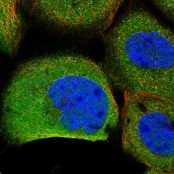 ITGB8 Rabbit anti-Human, Polyclonal, Invitrogen 100 &mu;L; Unconjugated:Antibodies,