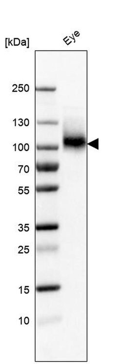 ITGB8 Rabbit anti-Human, Polyclonal, Invitrogen 100 &mu;L; Unconjugated:Antibodies,