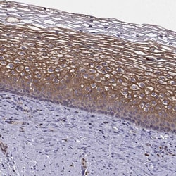 ITGB8 Polyclonal Antibody:Antibodies, Polyclonal