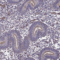 ITGB8 Polyclonal Antibody:Antibodies, Polyclonal