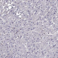 ITGB8 Polyclonal Antibody:Antibodies, Polyclonal