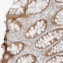 Invitrogen Neogenin Polyclonal Antibody 100 &mu;L; Unconjugated:Antibodies,