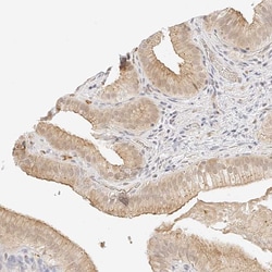 Invitrogen ZFP69 Polyclonal Antibody 100 &mu;L; Unconjugated:Antibodies,