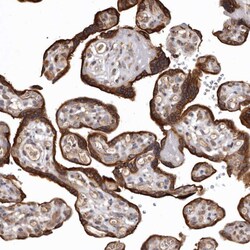 Invitrogen FAM212B Polyclonal Antibody 100 &mu;L; Unconjugated:Antibodies,