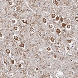 Invitrogen RSC1A1 Polyclonal Antibody 100 &mu;L; Unconjugated:Antibodies,
