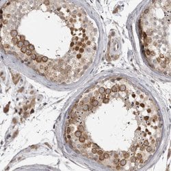 Invitrogen CKAP2 Polyclonal Antibody 100 &mu;L; Unconjugated:Antibodies,