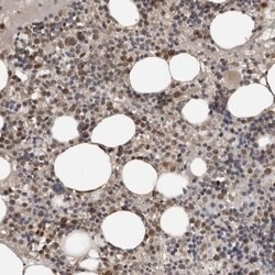 Invitrogen CKAP2 Polyclonal Antibody 100 &mu;L; Unconjugated:Antibodies,