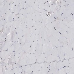 Invitrogen CKAP2 Polyclonal Antibody 100 &mu;L; Unconjugated:Antibodies,