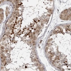 Invitrogen CKAP2 Polyclonal Antibody 100 &mu;L; Unconjugated:Antibodies,