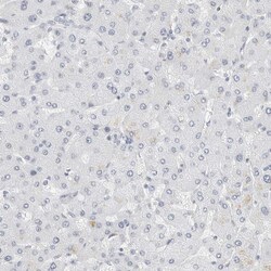 Invitrogen P4HA2 Polyclonal Antibody 100 &mu;L; Unconjugated:Antibodies,