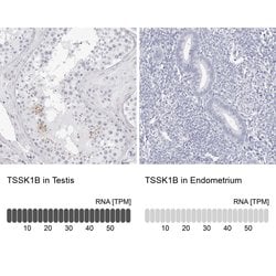 Invitrogen TSSK1 Polyclonal Antibody 100 &mu;L; Unconjugated:Antibodies,