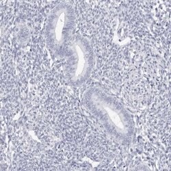 Invitrogen TSSK1 Polyclonal Antibody 100 &mu;L; Unconjugated:Antibodies,