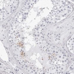 Invitrogen TSSK1 Polyclonal Antibody 100 &mu;L; Unconjugated:Antibodies,