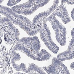 Invitrogen DMRT1 Polyclonal Antibody 100 &mu;L | Buy Online | Invitrogen&trade; | Fisher Scientific