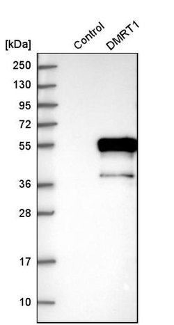 Invitrogen DMRT1 Polyclonal Antibody 100 &mu;L | Buy Online | Invitrogen&trade; | Fisher Scientific
