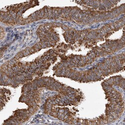 Invitrogen CDK5RAP3 Polyclonal Antibody 100 &mu;L; Unconjugated:Antibodies,