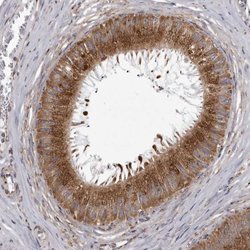 Invitrogen CDK5RAP3 Polyclonal Antibody 100 &mu;L; Unconjugated:Antibodies,