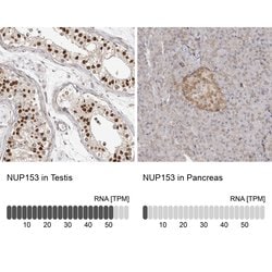 Invitrogen NUP153 Polyclonal Antibody 100 &mu;L; Unconjugated:Antibodies,