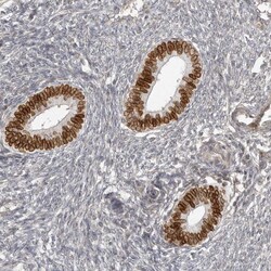 Invitrogen NUP153 Polyclonal Antibody 100 &mu;L; Unconjugated:Antibodies,