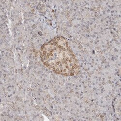 Invitrogen NUP153 Polyclonal Antibody 100 &mu;L; Unconjugated:Antibodies,