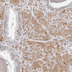 Invitrogen NUP153 Polyclonal Antibody 100 &mu;L; Unconjugated:Antibodies,