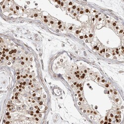 Invitrogen NUP153 Polyclonal Antibody 100 &mu;L; Unconjugated:Antibodies,