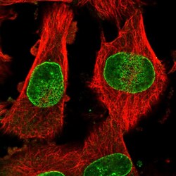 Invitrogen NUP153 Polyclonal Antibody 100 &mu;L; Unconjugated:Antibodies,