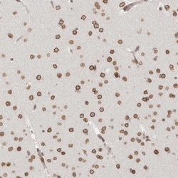 Invitrogen NUP153 Polyclonal Antibody 100 &mu;L; Unconjugated:Antibodies,