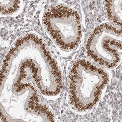 Invitrogen NUP153 Polyclonal Antibody 100 &mu;L; Unconjugated:Antibodies,